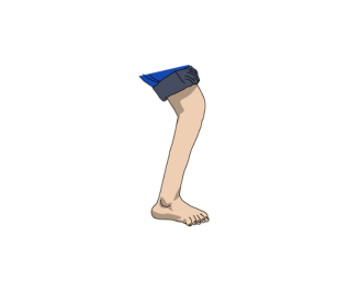 Marked excess dorsiflexion and knee flexion 