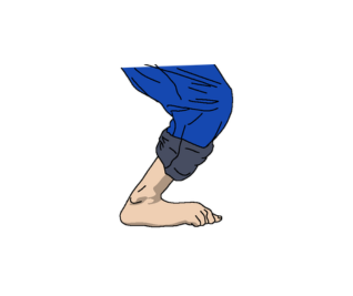 Significant excess dorsiflexion and knee flexion 