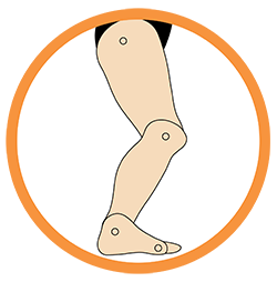 This image showcases structure of the foot that is suffering from Excess Dorsiflexion